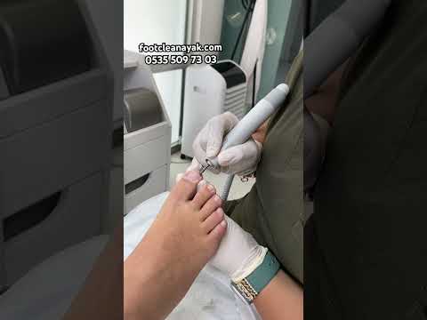 Pedikürün Zararları (Doğru Ayak Bakımı Nasıl Yapılır)
