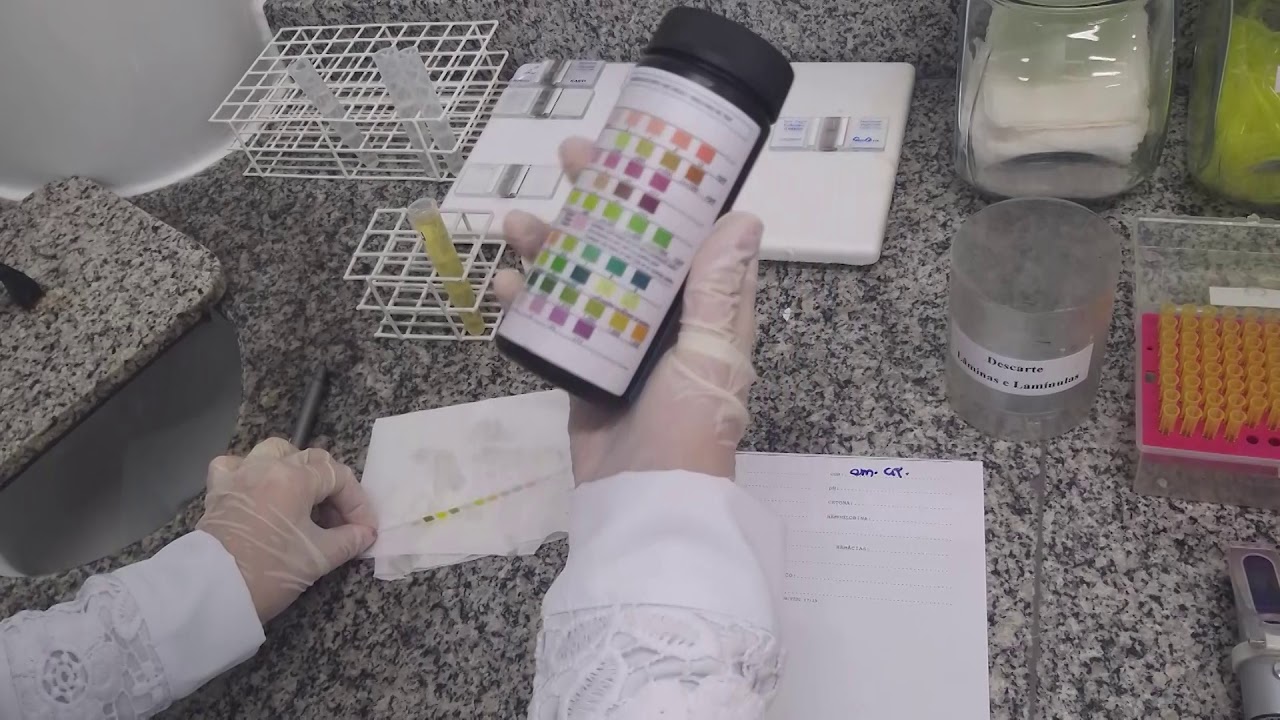 PARCIAL DE URINA (PU)