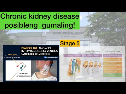DIALYSIS NGA BA ANG GAMOT SA STAGE 5 /CHRONIC KIDNEY DISEASE?