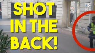 French Protester In A Coma After Riot Police Did This