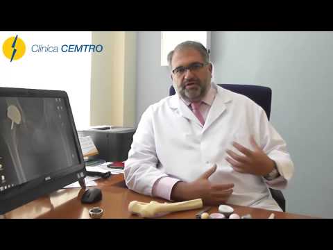 Lo que podría ser la causa del dolor en el codo La terapia de ejercicio después de reemplazo de cadera posterior periodo