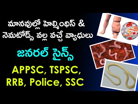 మానవుల్లో హెల్మింథిస్ & నెమటోడ్స్ వల్ల వచ్చే వ్యాధులు | Diseases caused by Helminths & Nematodes