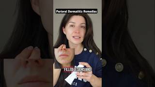How I got rid of my Perioral Dermatitis naturally