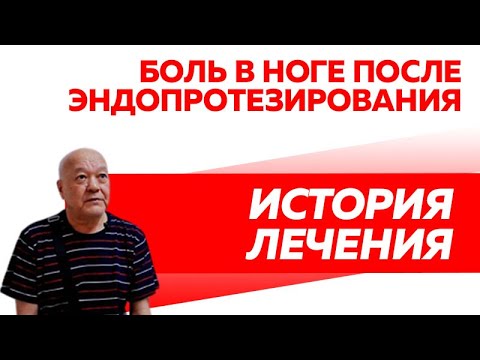 Реабилитация после операции по замене коленного сустава, эндопротезирование.