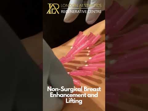 Breast Expansion Thread
