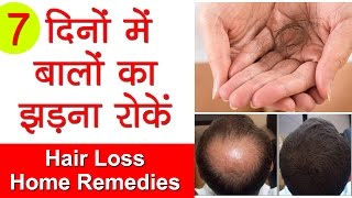 How to Stop Hair Fall, Cure Hair Loss &amp; Grow Long Hair | Ganjepan Ka Ilaaj with Onion Home Remedies