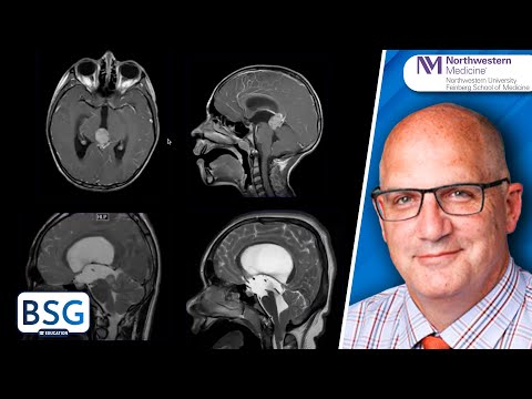 Endoscopic Third Ventriculostomy
