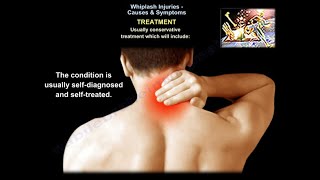 Whiplash Injuries Causes & Symptoms - Everything You Need To Know - Dr. Nabil Ebraheim