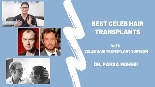 Best Celebrity Hair Transplants feat. Dr. Parsa Mohebi