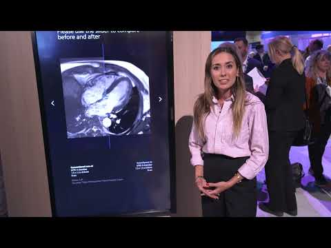 Improving lives with...Philips MR SmartSpeed