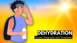 What is Dehydration Causes, Signs and Symptoms, Diagnosis and Treatment.