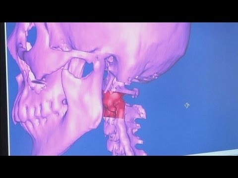 Il dolore della spalla destra e il collo Dolore acuto si arrende
