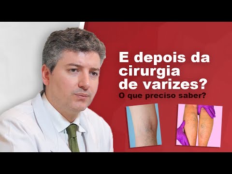What is the post-operative period like for conventional/traditional varicose vein surgery?
