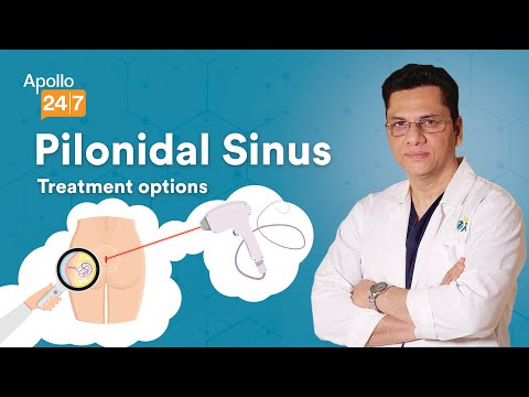 Can Pilonidal Sinus be Treated Without Surgery? | Dr Nitish Jhawar | Apollo 24|7