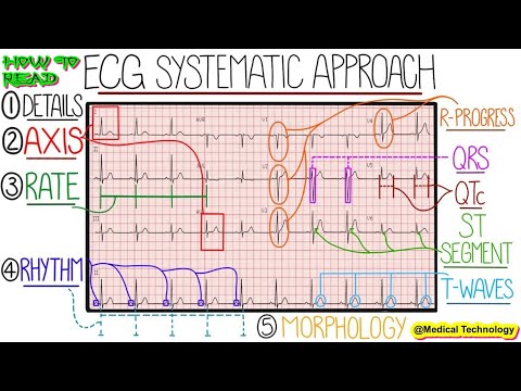 What is pacemaker how to work and Working Principle Advantage and Disadvantage