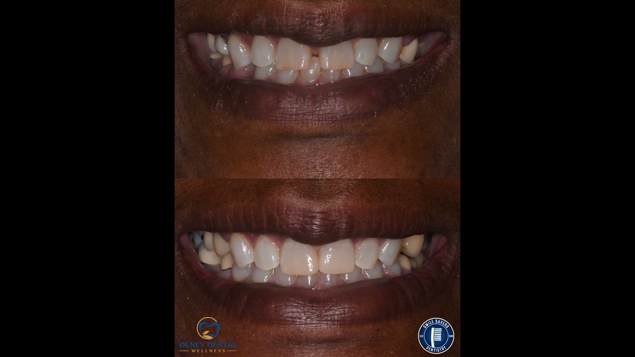 Smile Gallery Video 5