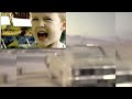 The Preview 2 Belpub Topspots Zazoo Little Boy Condoms Of Broken Dreams