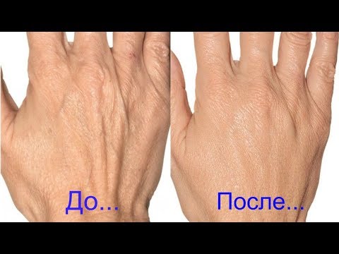 Супер-мазь для рук! Невероятный эффект!