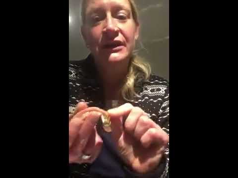 Teleskopprothese / Partial Dentures