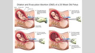 PFL-What God Thinks About Making a Nation Great - Scripture Reading and Reflection - Sept. 1, 2024