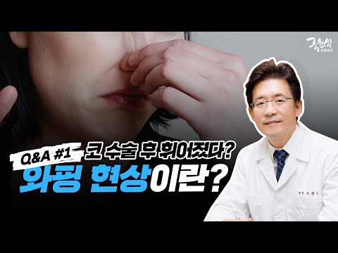 자가 연골 코 성형 후 코가 휘었어요! 와핑 현상이 나타난 진짜 이유! #1