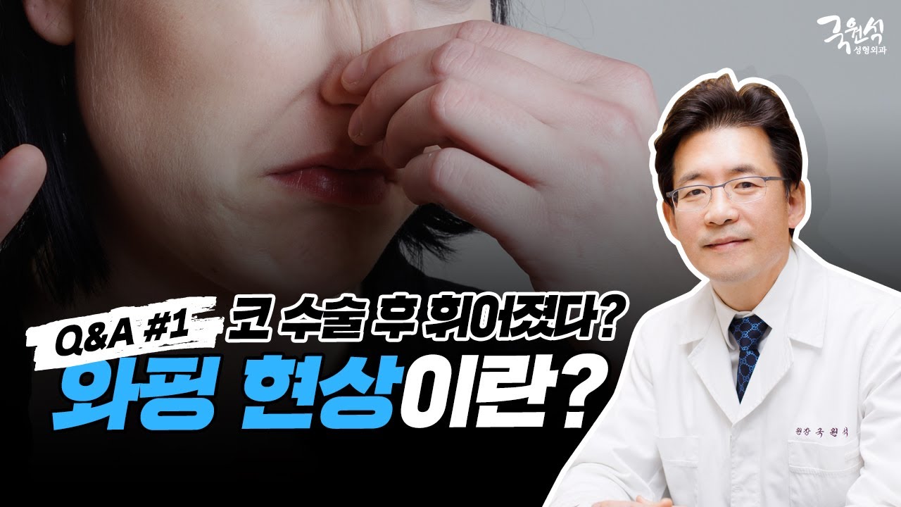 자가 연골 코 성형 후 코가 휘었어요! 와핑 현상이 나타난 진짜 이유! #1 썸네일