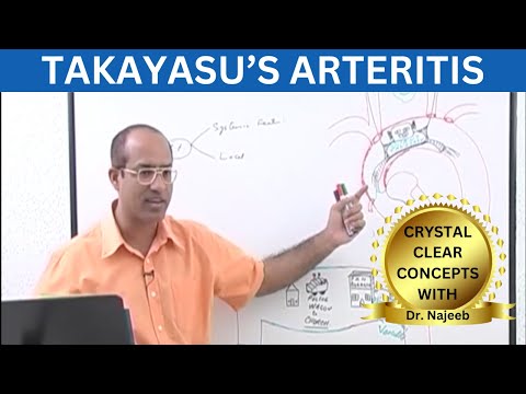 Takayasu's Arteritis | TAK | Complications | Management