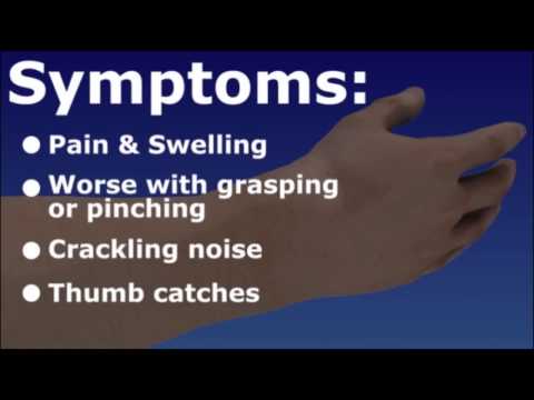 deQuervain's Tendonitis - Wrist Tendonitis