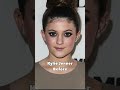 KYLIE JENNER Before And After Her Plastic Surgery Trending