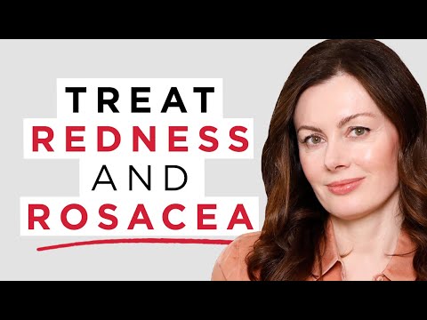 How To Treat Redness & Rosacea: The BEST 5 Ingredients To Reduce Redness| Dr Sam Bunting