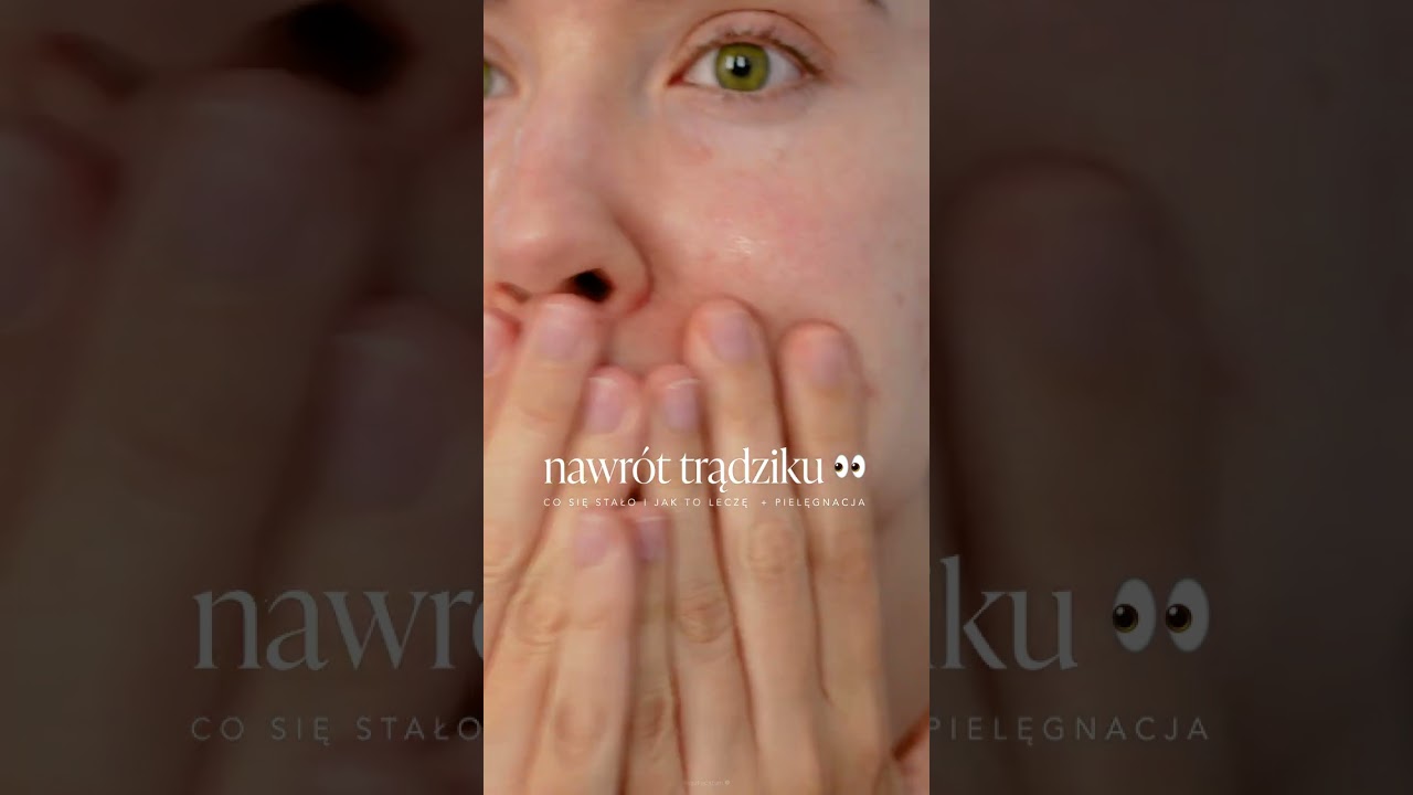 Q&A: Nawrót TRĄDZIKU 👀 Co się stało i jak to leczę #shortsfeed