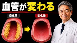 【動脈硬化を防ぐ】スーパーで買える最強食材と“やってはいけない習慣”【医師解説】