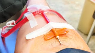 What Does It Feel Like to Donate Plasma? Answering Frequently Asked Questions About Donating Plasma