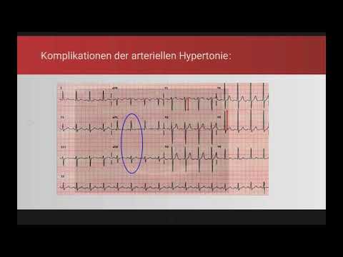 Wie die Hitze von Bluthochdruck zu entkommen Und die höchste Einzeltagesdosis dibasol