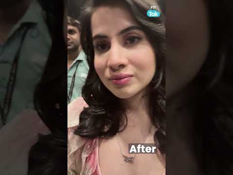 Urfi Javed’s Lip Filler Fix: From Painful Dissolve to Stunning Comeback!