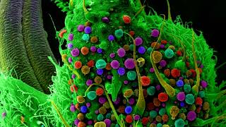 Cannabis-Marijuana Under Microscope