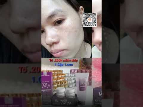 Kem Nám Tía Tô Giảm Nám Hiệu Quả - Giá Chỉ 140k Thay Vì 182k