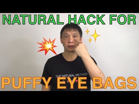 How to get rid of puffy eye bags naturally