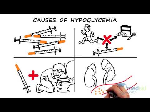 Type 2 diabetes mellitus pathogenesis