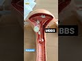 My Mbbs Journey Gynecologist Russia India Studyabroad Shortvideo Bsmu Shorts Subscribe 1k