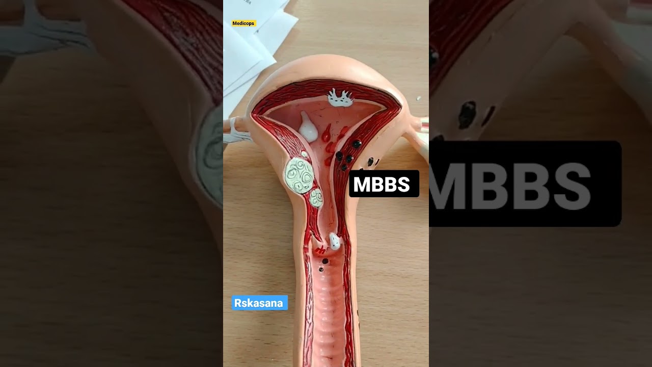 My mbbs journey #gynecologist  #russia  #india #studyabroad #shortvideo #bsmu #shorts #subscribe #1k