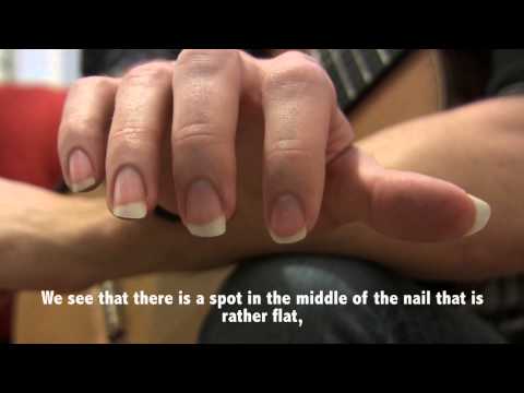 Guitar Technique: Nails - Thomas Viloteau