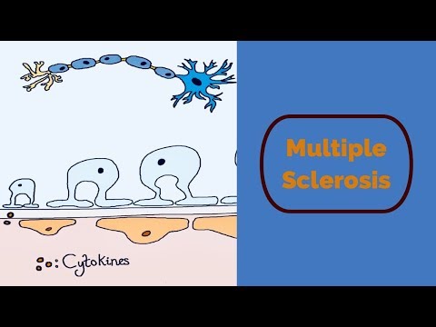 férgekkel járó sclerosis multiplex