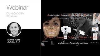 The Digital Patient: Guidelines to Optimize Predictable Surgical Workflows - Webinar with Dr. Tudts