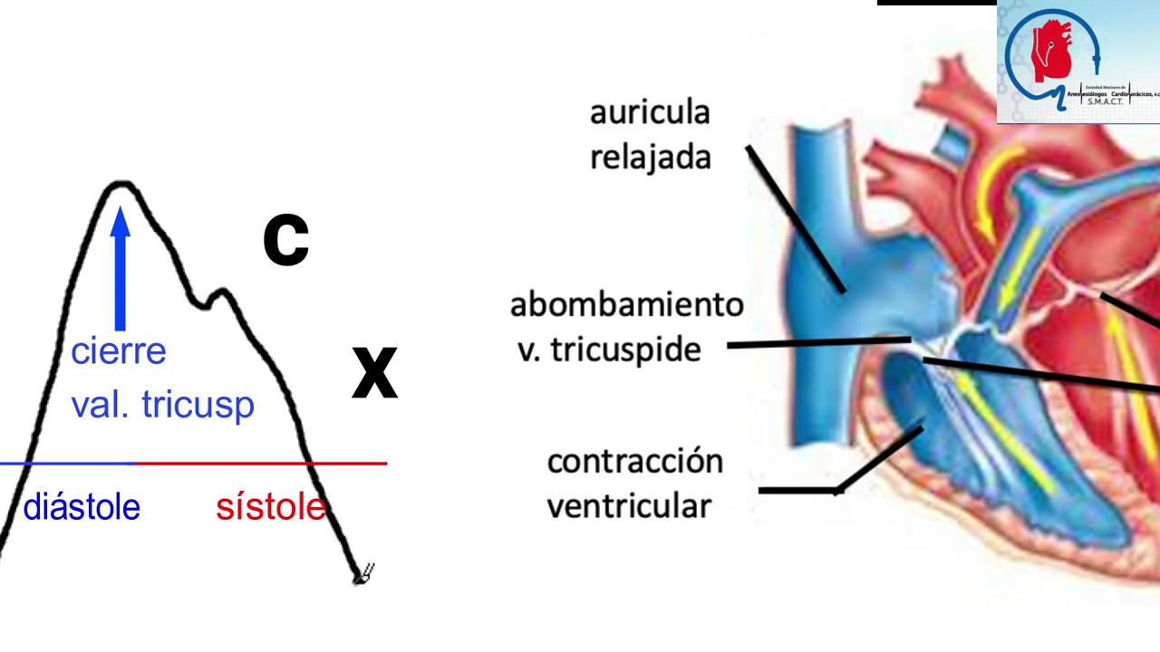 ¿Qué es el PVC y sus valores normales? LIB ASK