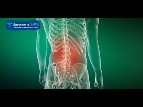 Detraleks mal di schiena Deck limpatto sulle articolazioni