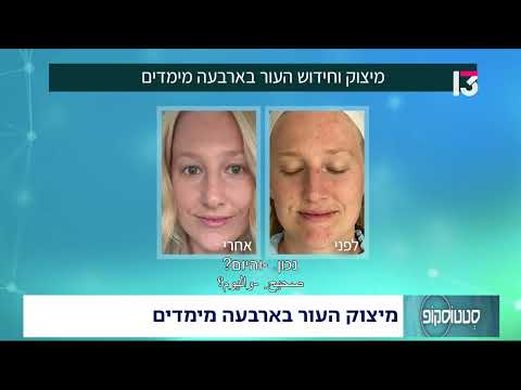  מיצוק העור בארבעה מימדים