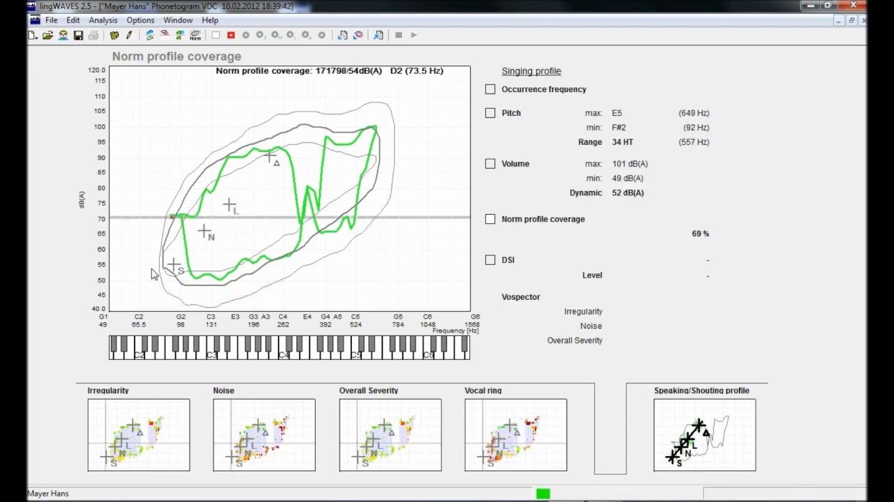 Antonio Tanzariello-17