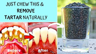 ✔️ 5 Natural Ways to Remove Tartar Buildup & Plaque on the teeth