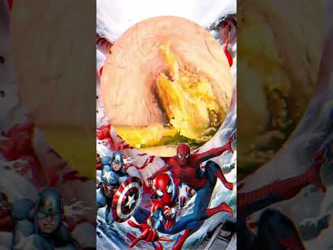 The earwax situation in both ears is different.|ear wax removal | ear cleaning | ASMR |relaxation#22